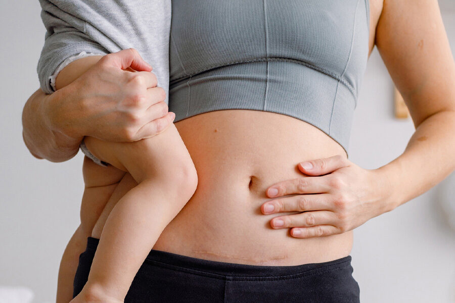 Why Skin Can Still Feel Different After Pregnancy